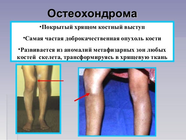 Ползунки своими руками выкройки Ползунки своими руками выкройки